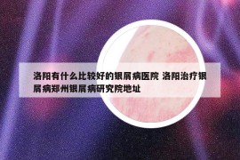 洛阳有什么比较好的银屑病医院 洛阳治疗银屑病郑州银屑病研究院地址