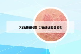 乙双吗啉胶囊 乙双吗啉胶囊网购