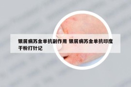 银屑病苏金单抗副作用 银屑病苏金单抗印度干粉打针记