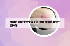 哈西奈德溶液哪个牌子好 哈西奈德溶液哪个品牌好