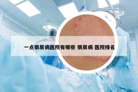 一点银屑病医院有哪些 银屑病 医院排名