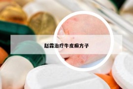 赵霖治疗牛皮癣方子