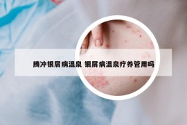 腾冲银屑病温泉 银屑病温泉疗养管用吗