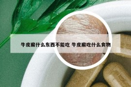 牛皮廨什么东西不能吃 牛皮廨吃什么食物