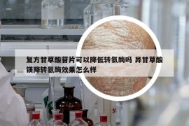 复方甘草酸苷片可以降低转氨酶吗 异甘草酸镁降转氨酶效果怎么样