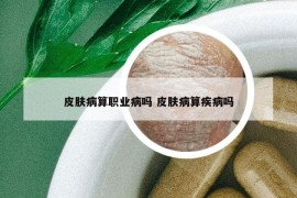 皮肤病算职业病吗 皮肤病算疾病吗