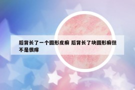 后背长了一个圆形皮癣 后背长了块圆形癣但不是很痒