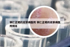 铜仁正规的皮肤病医院 铜仁正规的皮肤病医院排名