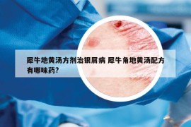 犀牛地黄汤方剂治银屑病 犀牛角地黄汤配方有哪味药?