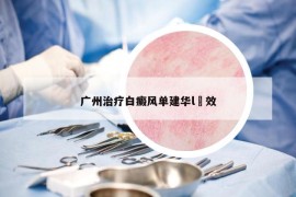 广州治疗白癜风单建华l髙效