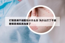 打银屑病干细胞估计什么价 为什么打了干细胞银屑病反而加重了