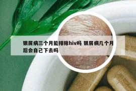 银屑病三个月能排除hiv吗 银屑病几个月后会自己下去吗