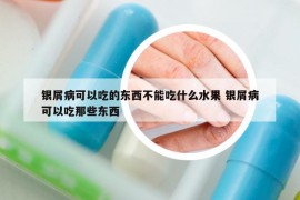 银屑病可以吃的东西不能吃什么水果 银屑病可以吃那些东西