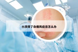 小孩得了白癜风应该怎么办