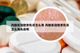 丙酸氯倍他索乳膏怎么用 丙酸氯倍他索乳膏怎么用头皮呢