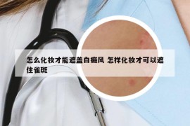 怎么化妆才能遮盖白癜风 怎样化妆才可以遮住雀斑