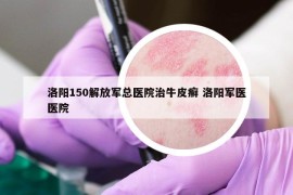 洛阳150解放军总医院治牛皮癣 洛阳军医医院