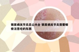 银屑病关节炎忌口大全 银屑病关节炎需要哪些注意吃的东西