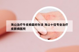 海口治疗牛皮癣最好办法 海口十佳专业治疗皮肤病医院