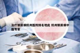 治疗银屑病杭州医院排名地此 杭州银屑病中医专家