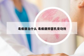 毒癣康治什么 毒癣康抑菌乳膏功效