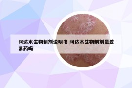 阿达木生物制剂说明书 阿达木生物制剂是激素药吗