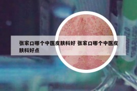 张家口哪个中医皮肤科好 张家口哪个中医皮肤科好点