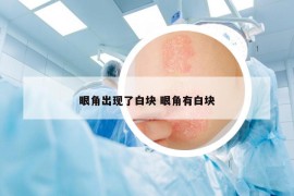 眼角出现了白块 眼角有白块