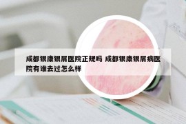 成都银康银屑医院正规吗 成都银康银屑病医院有谁去过怎么样