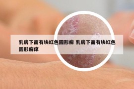 乳房下面有块红色圆形癣 乳房下面有块红色圆形癣痒