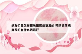 病友们是怎样预防银屑病复发的 预防银屑病复发的有什么药最好