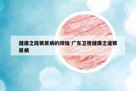 健康之路银屑病的烦恼 广东卫视健康之道银屑病