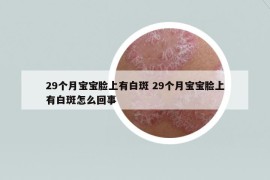 29个月宝宝脸上有白斑 29个月宝宝脸上有白斑怎么回事