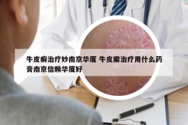 牛皮癣治疗妙南京华厦 牛皮廨治疗用什么药膏南京信赖华厦好