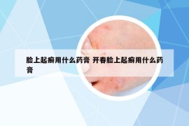 脸上起癣用什么药膏 开春脸上起癣用什么药膏