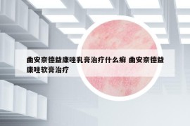 曲安奈德益康唑乳膏治疗什么癣 曲安奈德益康唑软膏治疗