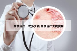 生物治疗一次多少钱 生物治疗大概费用