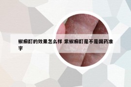 椒癣酊的效果怎么样 紫椒癣酊是不是国药准字