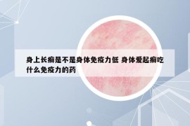 身上长癣是不是身体免疫力低 身体爱起癣吃什么免疫力的药