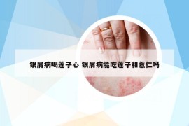 银屑病喝莲子心 银屑病能吃莲子和薏仁吗