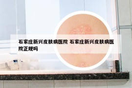 石家庄新兴皮肤病医院 石家庄新兴皮肤病医院正规吗