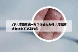 8岁儿童银屑病一年了还好治愈吗 儿童银屑病有终身不复发的吗