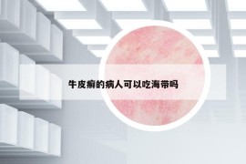 牛皮癣的病人可以吃海带吗