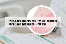 为什么眼角眼球内突然有一块白的 眼睛眼角眼球处有白色透明像膜一样的东西