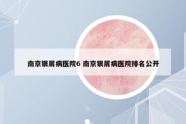 南京银屑病医院6 南京银屑病医院排名公开