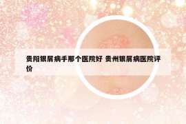 贵阳银屑病手那个医院好 贵州银屑病医院评价