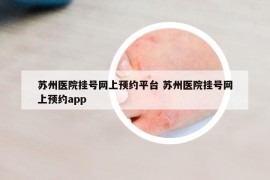 苏州医院挂号网上预约平台 苏州医院挂号网上预约app