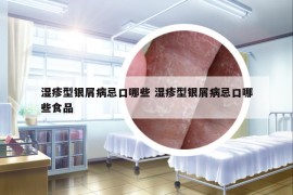 湿疹型银屑病忌口哪些 湿疹型银屑病忌口哪些食品