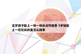 五岁孩子脸上一块一块白点咋回事 5岁娃脸上一坨坨白的是怎么回事