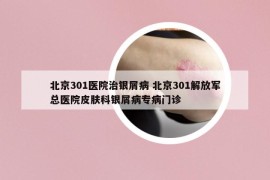 北京301医院治银屑病 北京301解放军总医院皮肤科银屑病专病门诊